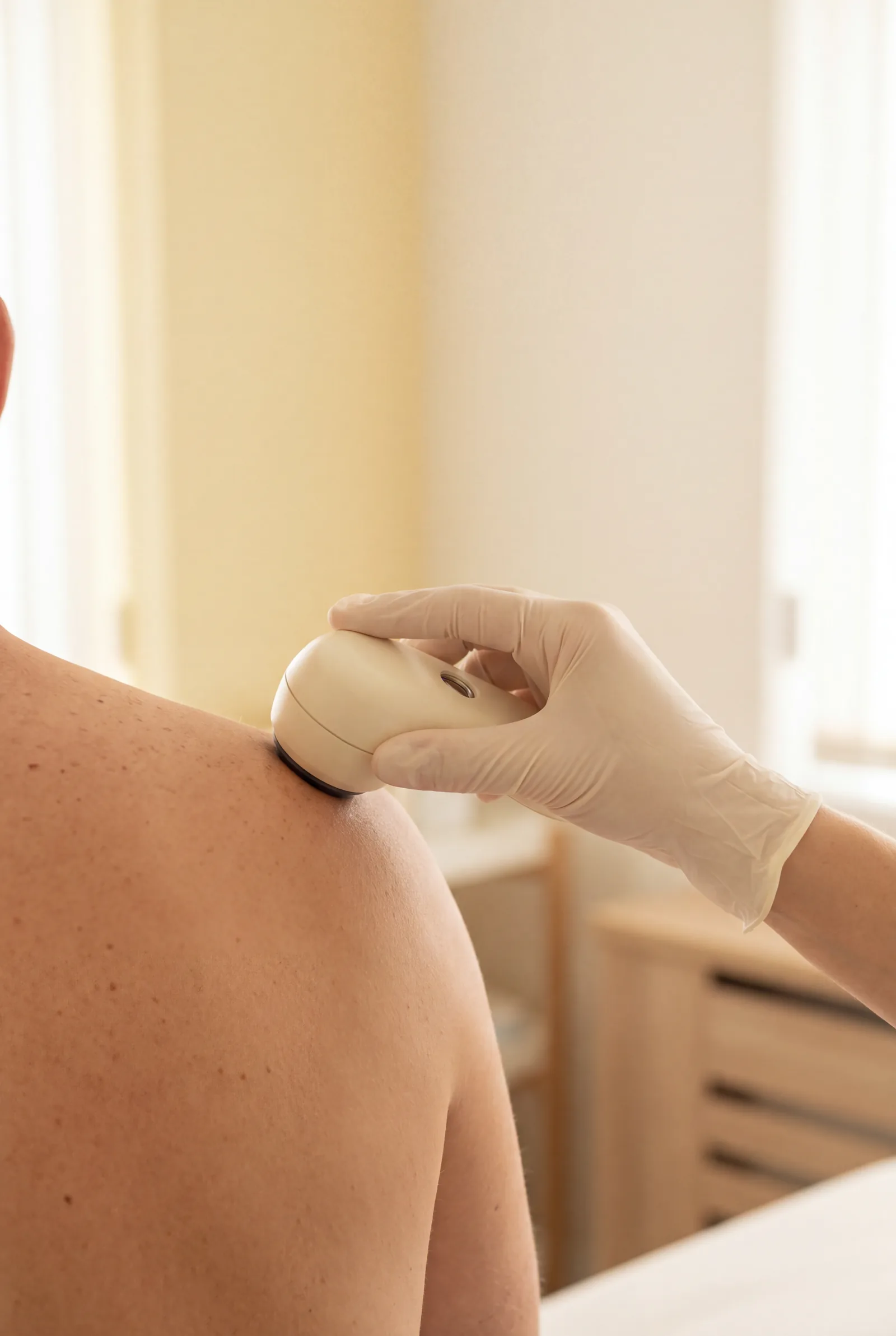 Behandschuhte Hand mit Dermatoskop an der Schulter, illustratives Motiv